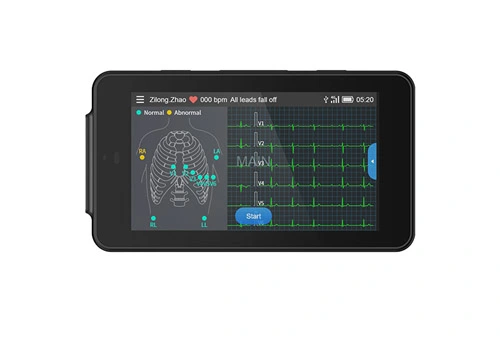 Lepu Medizinisches Hand-PCECG-500-Taschen-EKG-Gerät tragbar 12-Le-Rest-EKG-Monitor für Heim klinik und primäre Gesundheits versorgung